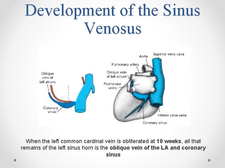 Development of the Sinus Venosus When the left common cardinal vein is obliterated at