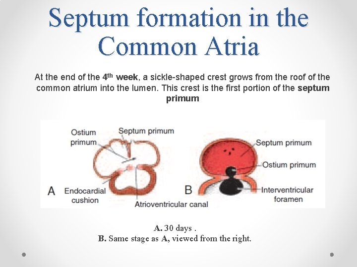 Septum formation in the Common Atria At the end of the 4 th week,