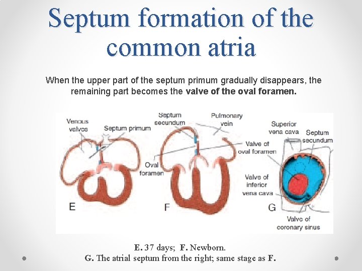 Septum formation of the common atria When the upper part of the septum primum