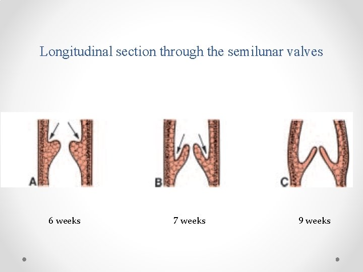 Longitudinal section through the semilunar valves 6 weeks 7 weeks 9 weeks 