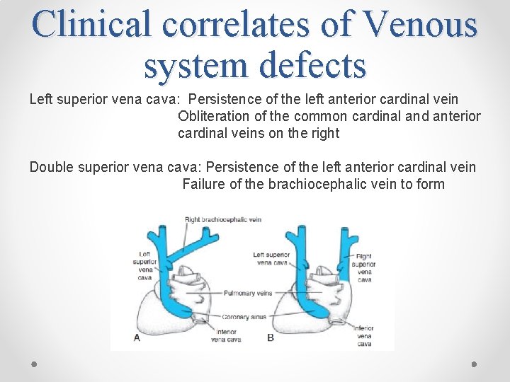 Clinical correlates of Venous system defects Left superior vena cava: Persistence of the left