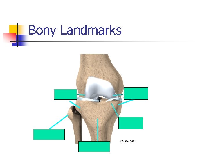 Bony Landmarks Fibular Head Tibial Tuberosity 