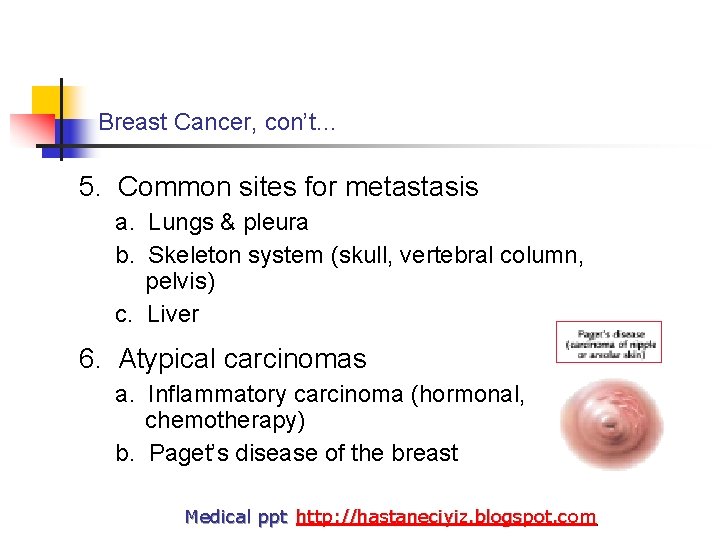Breast Cancer, con’t… 5. Common sites for metastasis a. Lungs & pleura b. Skeleton
