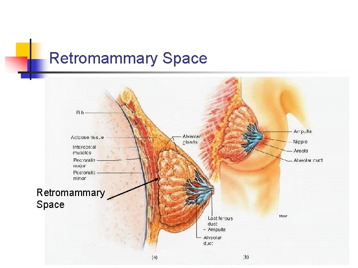 Retromammary Space 