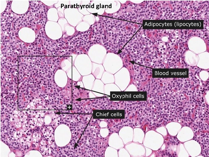 Parathyroid gland Parathyroid gland