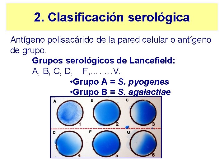 2. Clasificación serológica Antígeno polisacárido de la pared celular o antígeno de grupo. Grupos