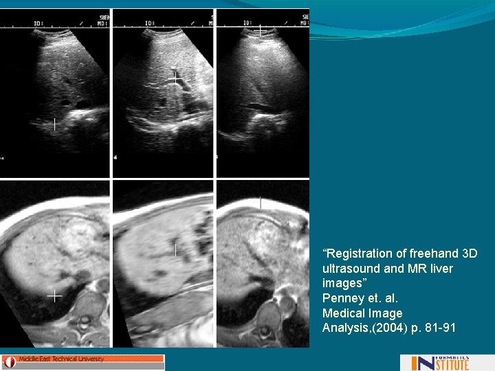 “Registration of freehand 3 D ultrasound and MR liver images” Penney et. al. Medical