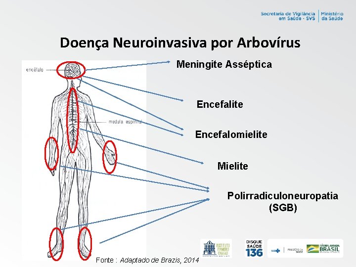 Doença Neuroinvasiva por Arbovírus Meningite Asséptica Encefalite Encefalomielite Mielite Polirradiculoneuropatia (SGB) Fonte : Adaptado