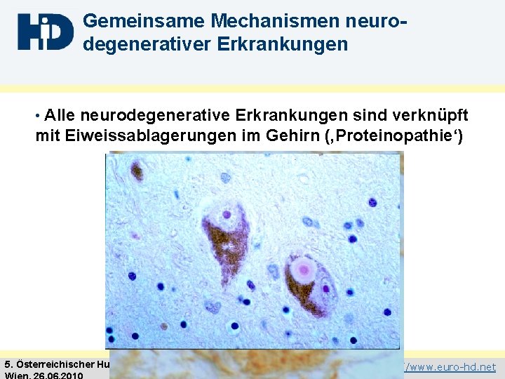 Gemeinsame Mechanismen neurodegenerativer Erkrankungen Alle neurodegenerative Erkrankungen sind verknüpft mit Eiweissablagerungen im Gehirn (‚Proteinopathie‘)