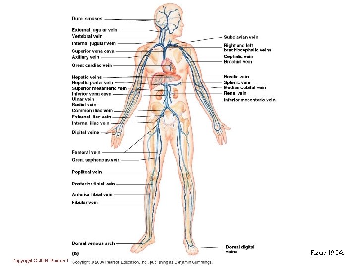 Figure 19. 24 b Copyright © 2004 Pearson Education, Inc. , publishing as Benjamin