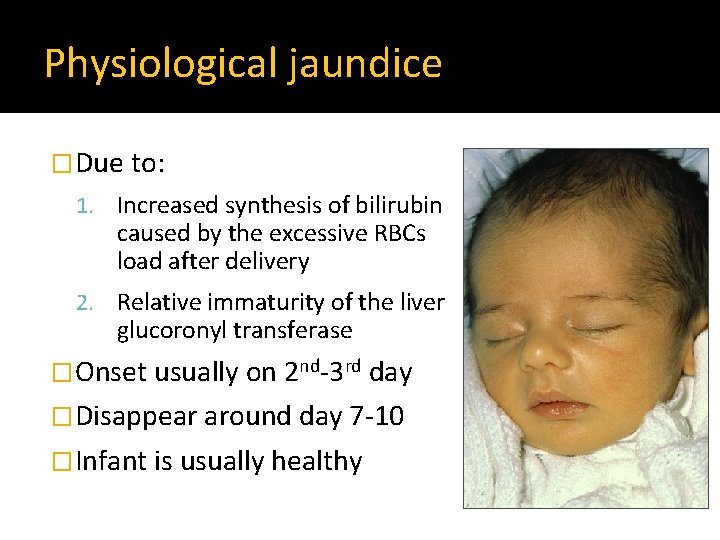 Physiological jaundice �Due to: 1. Increased synthesis of bilirubin caused by the excessive RBCs