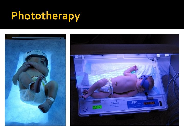 Phototherapy 