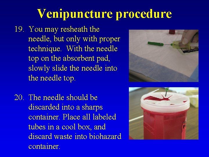 Venipuncture procedure 19. You may resheath the needle, but only with proper technique. With
