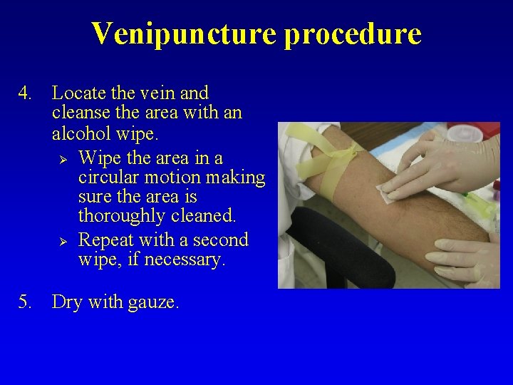 Venipuncture procedure 4. Locate the vein and cleanse the area with an alcohol wipe.