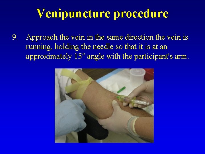 Venipuncture procedure 9. Approach the vein in the same direction the vein is running,