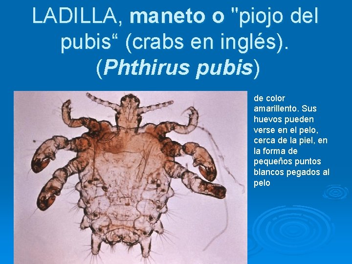 LADILLA, maneto o "piojo del pubis“ (crabs en inglés). (Phthirus pubis) de color amarillento.