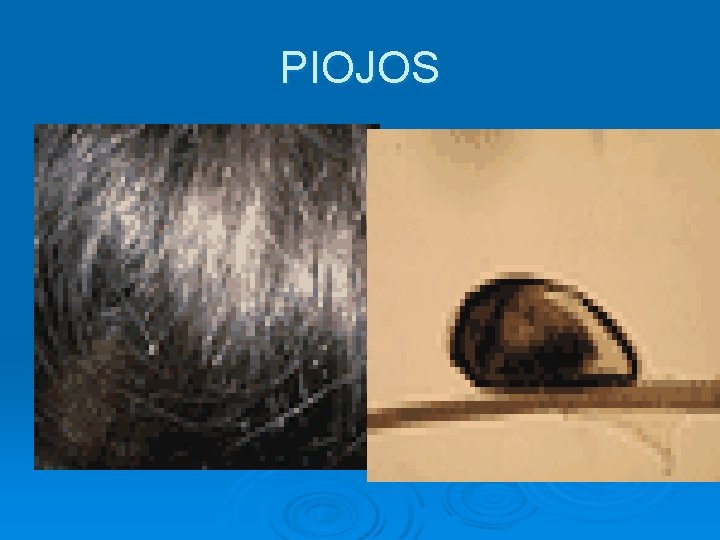 PIOJOS 