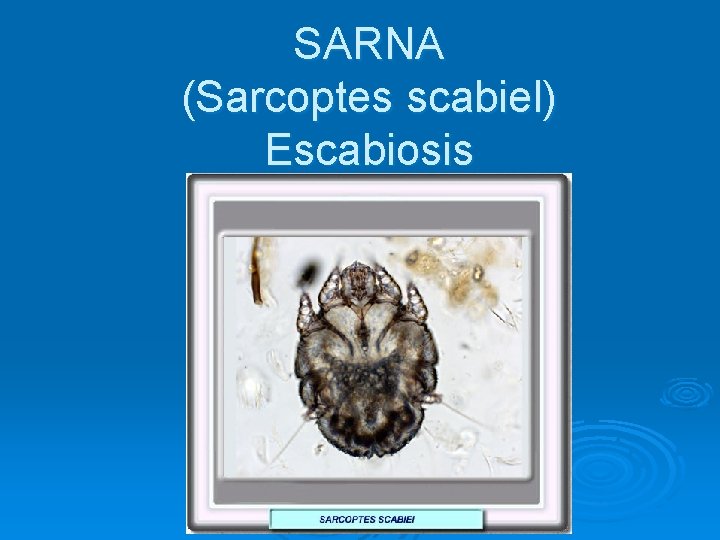 SARNA (Sarcoptes scabiel) Escabiosis 