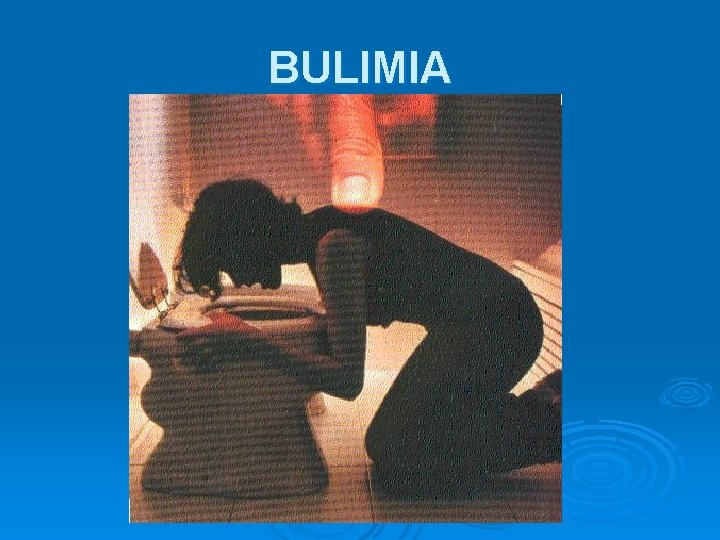 BULIMIA 