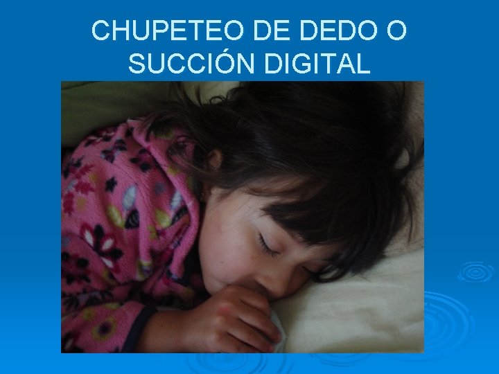 CHUPETEO DE DEDO O SUCCIÓN DIGITAL 