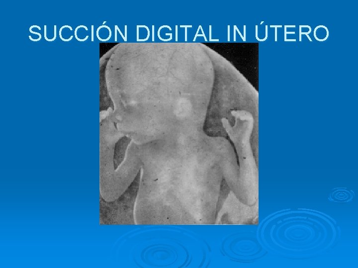 SUCCIÓN DIGITAL IN ÚTERO 