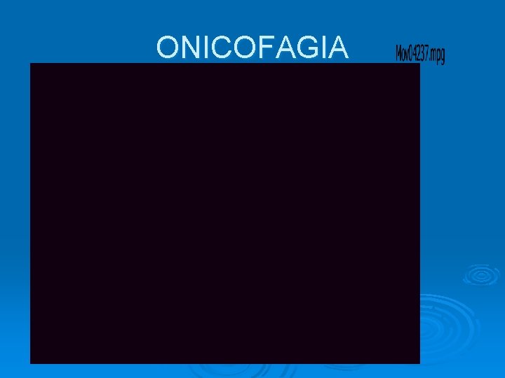 ONICOFAGIA 