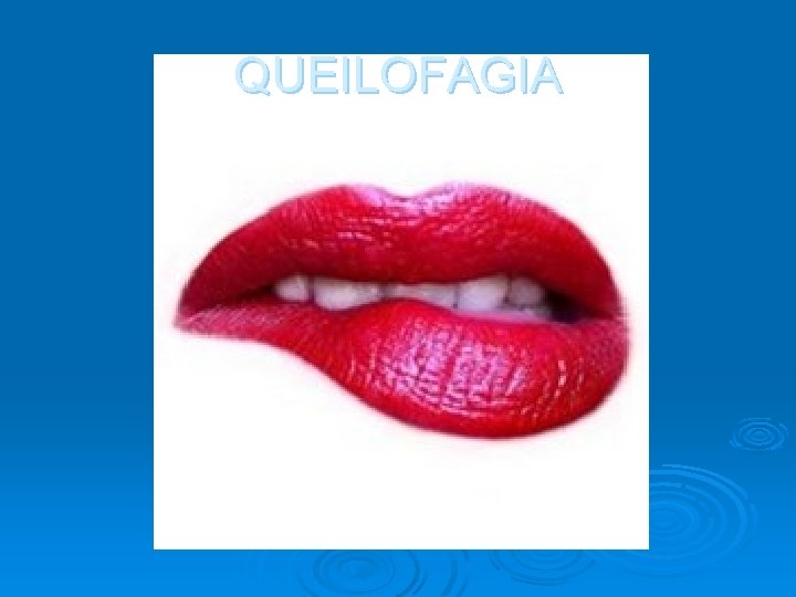 QUEILOFAGIA 