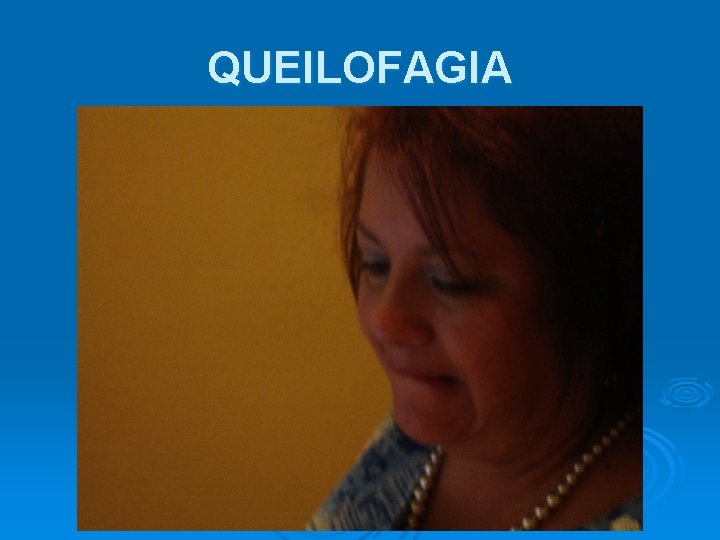 QUEILOFAGIA 