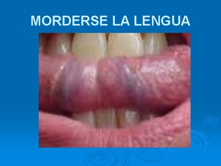 MORDERSE LA LENGUA 