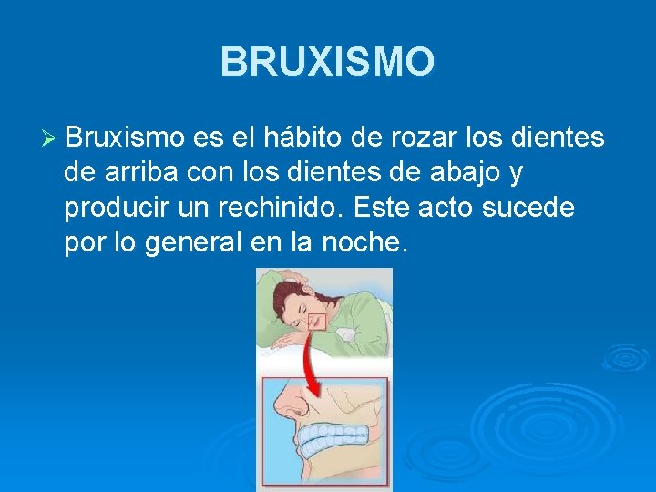 BRUXISMO Ø Bruxismo es el hábito de rozar los dientes de arriba con los