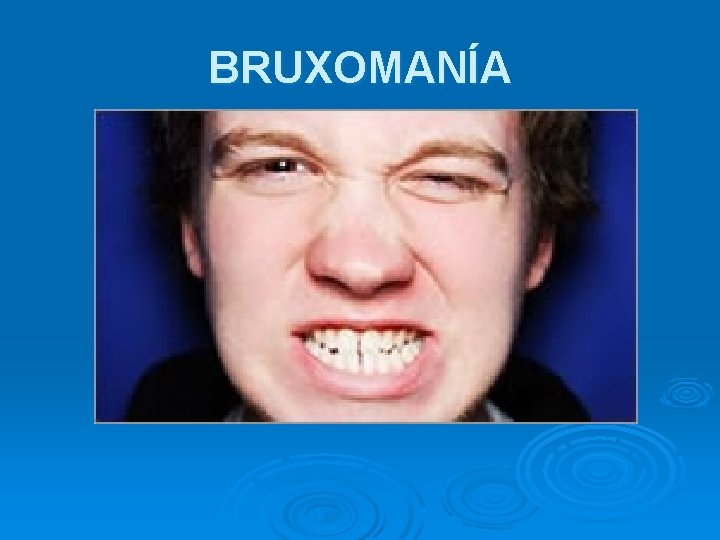 BRUXOMANÍA 