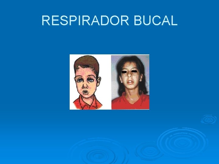 RESPIRADOR BUCAL 