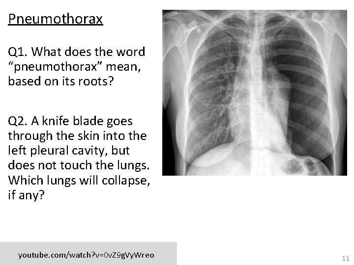 Pneumothorax Q 1. What does the word “pneumothorax” mean, based on its roots? Q