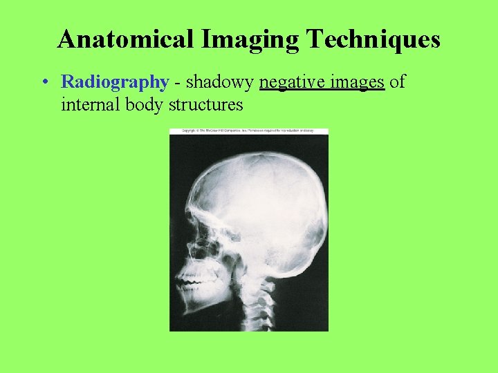 Anatomical Imaging Techniques • Radiography - shadowy negative images of internal body structures 