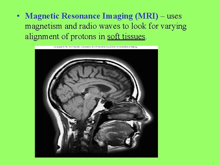  • Magnetic Resonance Imaging (MRI) – uses magnetism and radio waves to look