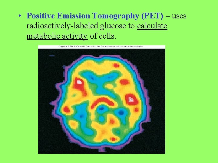  • Positive Emission Tomography (PET) – uses radioactively-labeled glucose to calculate metabolic activity