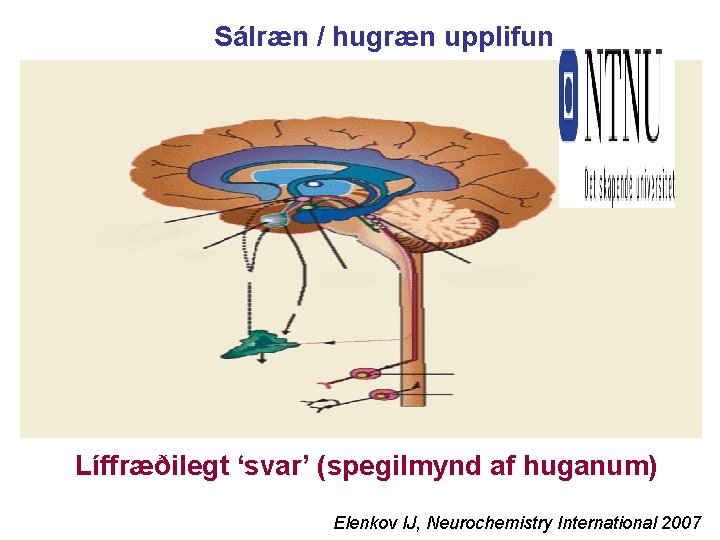 Sálræn / hugræn upplifun Líffræðilegt ‘svar’ (spegilmynd af huganum) Elenkov IJ, Neurochemistry International 2007