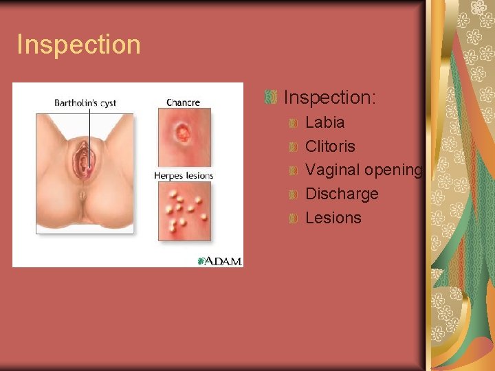 Inspection: Labia Clitoris Vaginal opening Discharge Lesions 