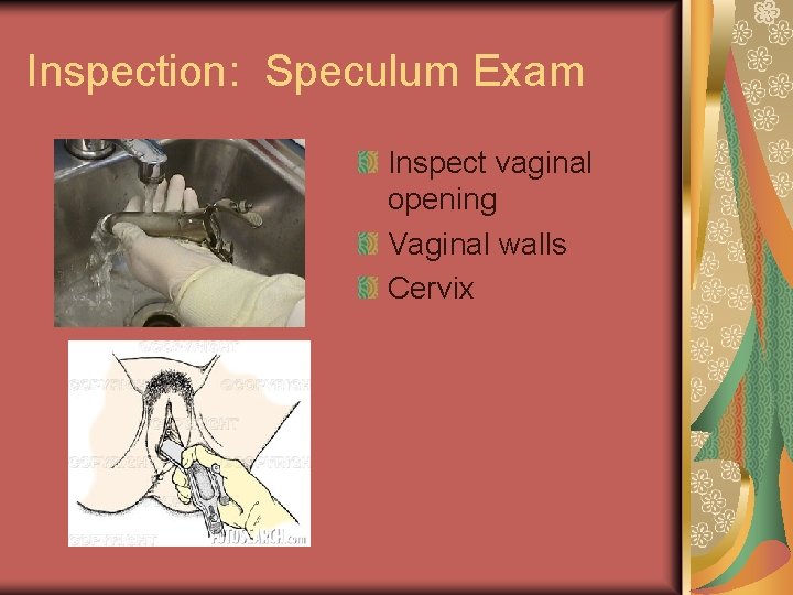 Inspection: Speculum Exam Inspect vaginal opening Vaginal walls Cervix 