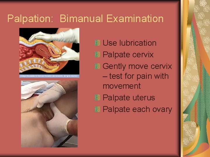 Palpation: Bimanual Examination Use lubrication Palpate cervix Gently move cervix – test for pain