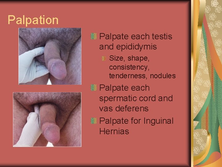 Palpation Palpate each testis and epididymis Size, shape, consistency, tenderness, nodules Palpate each spermatic