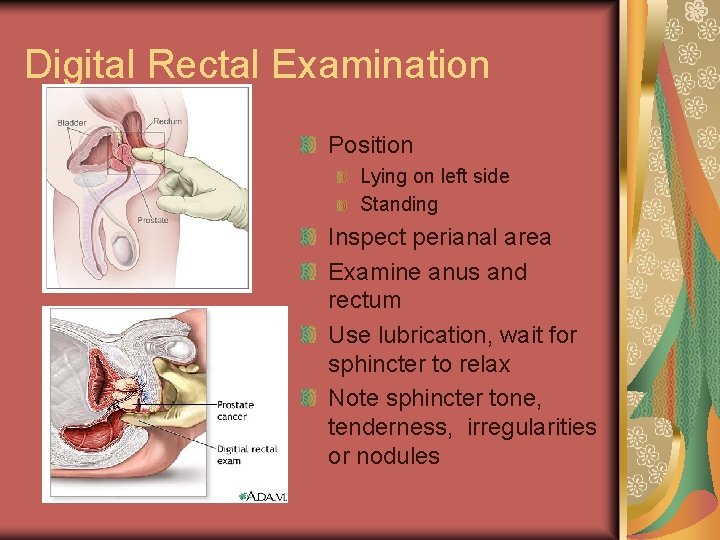 Digital Rectal Examination Position Lying on left side Standing Inspect perianal area Examine anus