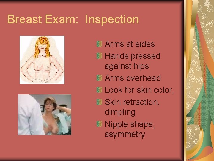 Breast Exam: Inspection Arms at sides Hands pressed against hips Arms overhead Look for