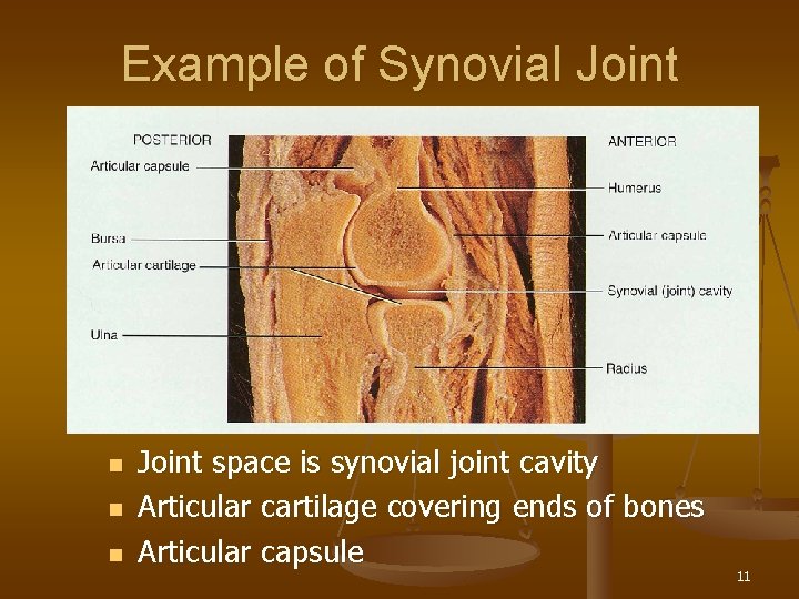 Example of Synovial Joint n n n Joint space is synovial joint cavity Articular