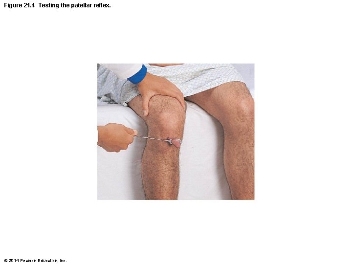Figure 21. 4 Testing the patellar reflex. © 2014 Pearson Education, Inc. 