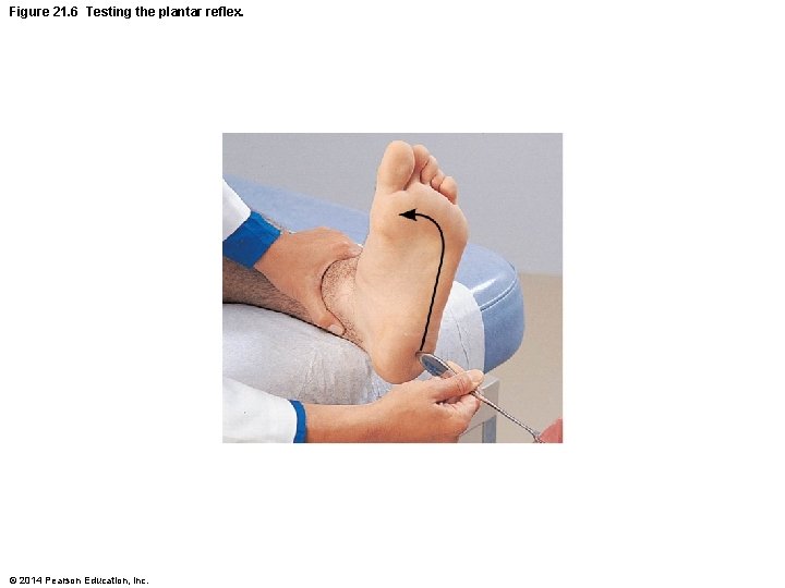 Figure 21. 6 Testing the plantar reflex. © 2014 Pearson Education, Inc. 