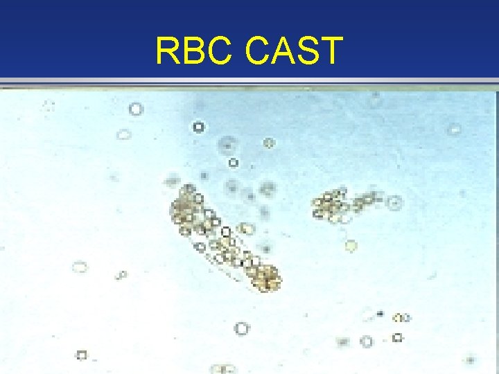 RBC CAST 