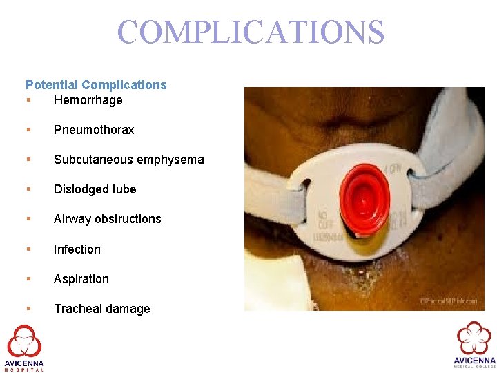 COMPLICATIONS Potential Complications § Hemorrhage § Pneumothorax § Subcutaneous emphysema § Dislodged tube §