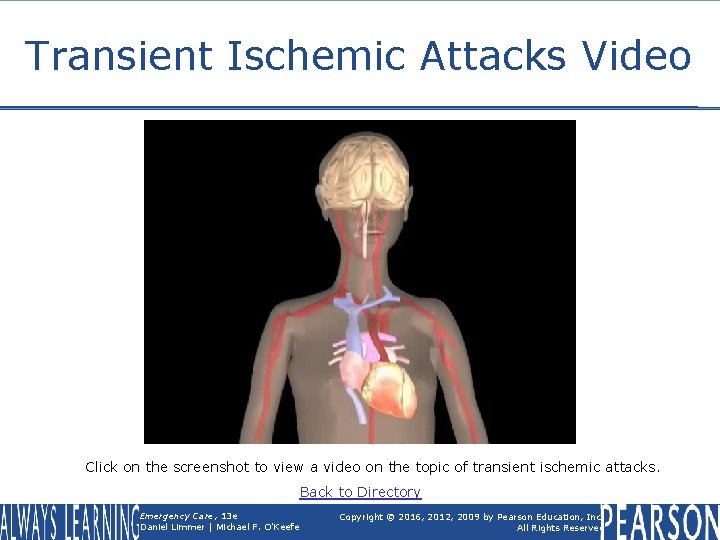 Transient Ischemic Attacks Video Click on the screenshot to view a video on the