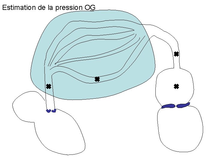 Estimation de la pression OG 